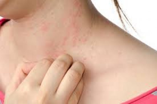 alergia al semen